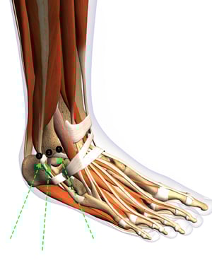 LateralAnkleDiagram